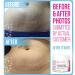 Pregnancy Stretch Mark & Scar Removal Cream - Shea & Cocoa Butter - Maternity Skin Care - Buy Online on GoSupps.com