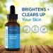 Retinol Serum with Hyaluronic Acid, Vitamin E, and Aloe Vera - Anti-Aging, Dark Spot Corrector, Collagen Booster, Acne Treatment - 4oz - Buy Online on GoSupps.com