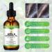 Amla Oil 60ML - Natural & Vegan Hair Oil for Healthy Growth Thicker Fuller Shinier Hair for Men & Women - International Shipping Available - Buy Online on GoSupps.com