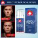 2023 Advanced Silicone Scar Gel - 100% Medical Grade - Reduces Scars, Stretch Marks, Surgery Scars, Injuries, Burns, Acne Scars - Buy Online on GoSupps.com