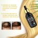 5% Minoxidil for Men & Women - Boost Hair Growth Thicker Fuller Hair & Beard Prevent Hair Loss - Buy Online on GoSupps.com