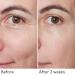 By Terry Hyaluronic Global Face Serum - Reduces Wrinkles & Fine Lines Vegan Fragrance-Free All Skin Types - 1.1 fl oz | International Shipping Available - Buy Online on GoSupps.com