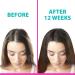 Z2 Hair Growth Serum - 1.69 fl oz | Natural Scalp Treatment for Hair Regrowth | Powerful Solution for Women and Men | Intensive Strengthening with Essential Oils - Buy Online on GoSupps.com