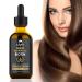 ELEVATE Hair Growth Oil - Biotin & Castor Oil Serum for Stronger, Thicker Hair Growth - Prevents Loss & Thinning - Men & Women - 2 Fl Oz - Buy Online on GoSupps.com