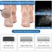 Sejoy Electric Feet Callus Removers Rechargeable 3 Grinding Heads Portable Waterproof Electronic Foot File Pedicure Tools Professional Pedi Feet Care for Dead Hard Cracked Dry Skin - Buy Online on GoSupps.com
