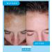Admire My Skin Dark Spot Corrector Serum + Retinoid Cream Set - Buy Online on GoSupps.com