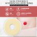 Adapt Barrier Rings 2 48mm Box of 10 by MED Supplies - Ostomy Medical Supplies - Buy Online on GoSupps.com
