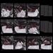 Niceneeded 10 packs 500 pieces of artificial false pointed clear acrylic falsche nails in 10 sizes with 5 pieces of nail glue for nail art manicure accessories (white style 4))