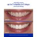 Buy Supersmile The Works Whitening Toothpaste & Activator - Sassy Mint | International Shipping Available - Buy Online on GoSupps.com