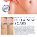 Scar Remover Gel for C-Section Stretch Marks Acne Surgery - 30g (1.05oz) | Effective on Old & New Scars - Buy Online on GoSupps.com