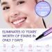 VieBeauti Deluxe Teeth Whitening Kit - Enamel-Safe LED Light & Gel Pen for Sensitive Teeth - Professional Stain Removal - Buy Online on GoSupps.com