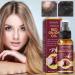 Onion Hair Thickening Spray - 30ml Onion Oil Hair Anti Loss Spray | Red Onion Hair Oil For Hair Regrowth Strengthening Hair Roots And Follicles | Pure Onion Oil Spray For Hair Thickening - Buy Online on GoSupps.com