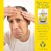Vapon Topstick Men's Grooming Tape - 50 Clear Double Sided Strips for Toupee & Wig Adhesive - Buy Online on GoSupps.com