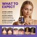 Biotin Hair Growth Supplement with Collagen, Keratin, and Probiotics Hair Growth Support, Skin & Nails Supplement for Men and Women Supports Thicker, Stronger Hair Made in USA (1 Pack) 60 Count (Pack of 1) - Buy Online on GoSupps.com