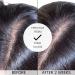 Alevai Stem Cell Anti Dandruff Shampoo - Itchy Scalp Treatment - 2% Pyrithione Zinc - Sulfate-Free - Vegan - 16 oz - Buy Online on GoSupps.com