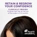 Head & Shoulders Scalp X 2% Minoxidil for Women - Hair Regrowth Treatment Thinning Hair & Hair Loss Solution 3 Month Supply (3 x 2 Fl Oz - Buy Online on GoSupps.com