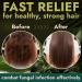 Terramed Just Think Comfort Tea Tree Shampoo & Conditioner Set - Itchy Scalp Hair Loss & Dandruff Relief | Nourishing Sulfate & Paraben Free Haircare for All Hair Types - Buy Online on GoSupps.com