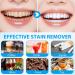 Usmlicer Professional whitening set tooth whitening agent gentle and effective whitening teeth for a whiter smile - Buy Online on GoSupps.com