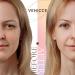 Venicce Love Slide Stripes | Invisible Eyelid Adhesive Tape for Lifting & Support | 160m - Enhance Your Eyes Naturally - Buy Online on GoSupps.com