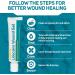 Care Science Antibacterial Wound Gel with Lidocaine 1 oz - Pain Relief Hydrogel for Cuts, Scrapes & Burns - Germ Shield Healing Treatment, Reduces Scarring, Prevents Infection - First Aid Essential - Buy Online on GoSupps.com