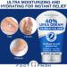 LOVE LORI Urea Cream 40% for Cracked Heel Repair (4oz) - Intensive Foot Repair & Callus Remover - Hydrating Foot Lotion - Buy Online on GoSupps.com