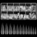 KOXXIAMOQ 240 pieces of nail tips tips for gel nails Coffin nail tips wrong nails tips water drops nail tips extra long artificial nails acrylic artificial trace without a trace nail tips (transparent)