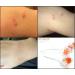 Dns Derma Skin Roller For Winkles & Scars (1.0mm) - Buy Online on GoSupps.com