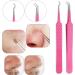 Pink Blackhead Remover Tool Kit - 10 Pcs Acne Extractor Set for Pimple, Blackhead, and Whitehead Removal - Buy Online on GoSupps.com