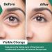 Vivo Per Lei Vitamin C Eye Cream - Anti-Aging Retinol & Peptide Formula for Puffiness Wrinkles & Dark Circles - 1.7 Fl. Oz - Buy Online on GoSupps.com