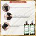 Fermosa Apple Cider Vinegar Shampoo & Conditioner Set - Clarifying Nourishing Sulfate-Free for Itchy Scalp Dandruff & Frizz - 16.9oz/500ml - Buy Online on GoSupps.com