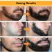 MISICH Beard Derma Roller for Men - 540 Titanium Microneedle Daily Use Beard Roller Black - Buy Online on GoSupps.com