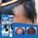  Yhsioaklo Care Hair Loss Cream | Hair Growth Oil | 20g Repair Cream for Hair Loss | Anti-Alopecia Serum - Buy Online on GoSupps.com