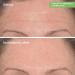 MURAD Rapid Wrinkle Repair Kit - Worth 168 Save 40 percent - 2 Full Sizes to Smooth Wrinkles in an Instant and Over Time - Eye Serum - Wrinkle Correcter - Buy Online on GoSupps.com