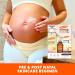 Palmer's Vitamin E Mom's Skin Healing Body Care Kit - Pregnancy & Postpartum Essentials: Body Oil Scar Serum & Concentrated Cream - Buy Online on GoSupps.com