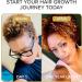 Shedavi Iconic Natural Hair Vitamins for Fast Hair Growth - Pure Hair Supplements Formulated with Vitamins to Promote Thicker Stronger Hair - Vegan Hair Care for Hair Loss - Non-GMO (60 Capsules) - Buy Online on GoSupps.com
