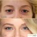 Jerome Alexander CoverAge Eye Concealer - 5-in-1 Anti-Aging Concealer Stick with Eye Roller Ball - Buy Online on GoSupps.com