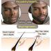 Nikka Notto QMD Derma Roller for Hair Growth & Beard Growth - 0.25mm Facial Skin Care for Women & Men - Banish Scars, Dermaroller Gold - Buy Online on GoSupps.com
