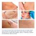 Scar Remover Gel for C-Section Stretch Marks Acne Surgery - 30g (1.05oz) | Effective on Old & New Scars - Buy Online on GoSupps.com