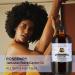 Sunny Isle Rosemary Jamaican Black Castor Oil 8oz - Hair Growth & Scalp Care | Hot Oil Treatment for Acne Prone Skin - Buy Online on GoSupps.com