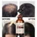 Hair Serum for Scalp Repair | Herbal Extracts with Ginseng & Ginger | Daily Use Massage Serum for Men & Women - Buy Online on GoSupps.com