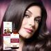 Hair Growth Oil Natural Hair Regrowth Oil Anti-Frizz Formula Oil Natural Hair Oil Biotin Argan Oil Coconut Oil And Rosemary Oil Effective Thickening & Hair Loss Treatments - Buy Online on GoSupps.com