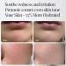 CICA Aloe Hydrating Toner Spray for Face - pH Balanced Facial Mist - Aloe Vera and Centella Asiatica - for Acne Prone and Sensitive Skin - Korean Skincare for Redness Dryness - Buy Online on GoSupps.com