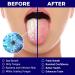 Stainless Steel Tongue Scraper Three-Pack | For Fresh Breath and Oral Health | Kids and Adults | ORAVIX Pack of 3 - Buy Online on GoSupps.com