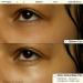 Buy Youth To The People Peptides + Vitamin C Eye Serum | Caffeine Eye Gel for Puffiness & Dark Circles - 15ml - Buy Online on GoSupps.com