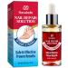 Toenail Fungus Treatment  Toe Nail Fungus Treatment for Toenail Extra Strength - Nail Repair Solution for Damaged and Discolored Nails - Nail Renewal Liquid for Toenail or Fingernail Fungus