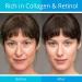 Anti-Aging Retinol & Collagen Face Cream for Women & Men - 50ml - Buy Online on GoSupps.com