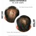 S rum de croissance des cheveux pour favoriser la croissance des cheveux et contr ler la chute des cheveux avec 3 % Redensyl 5 % Capixyl 4 % Anagain 3 % Procapil 3 % Baicapil romarin et - Buy Online on GoSupps.com