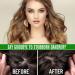 Batana Oil for Hair Growth Natural Organic Batana Hair Treatment Oil Prevents Hair Loss eliminates Split Ends & Increases Shine Batana Oil for Healthier Thicker Fuller Hair 60ML - Buy Online on GoSupps.com