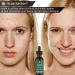 Naturenics Tea Tree Essential Oil - 100% USDA Organic Melaleuca Alternifolia - Therapeutic Grade for Acne, Toenail, Lice, Hair, Face & Skin Issues - 1 Fl Oz - Buy Online on GoSupps.com