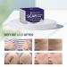 MURASAKI BEAUTY Scar Cream - Stretch Mark & Scar Removal Treatment - 1 oz. / 30g - Buy Online on GoSupps.com